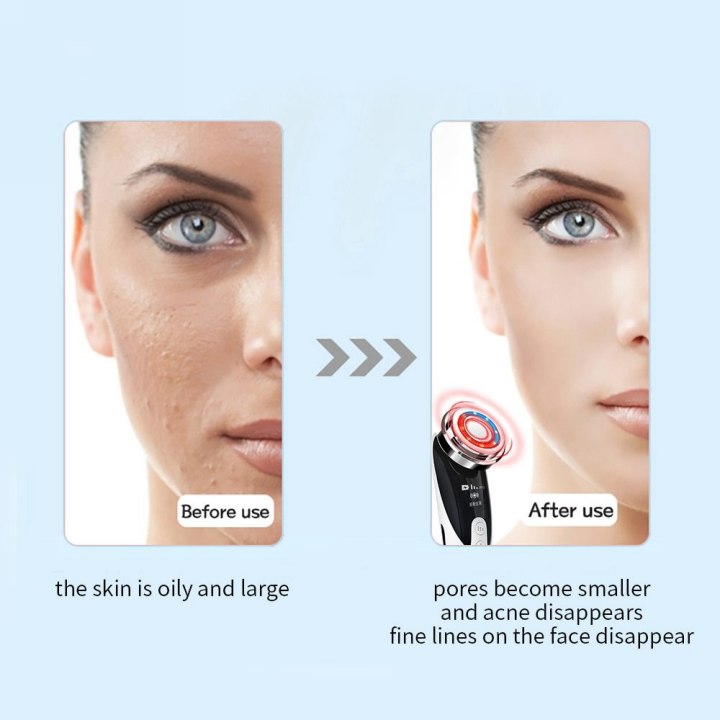 Face massager facial lifting